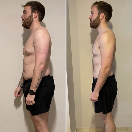 Résultat avant/après